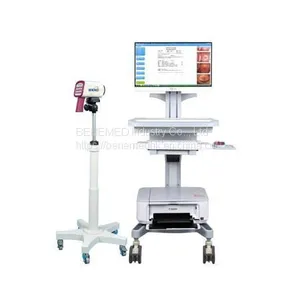 Medical Equipment Digital Video Colposcope for Gynecology thumbnail-2