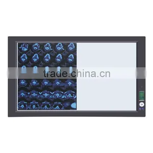 Led x Ray Medical View Box thumbnail-2