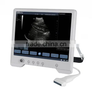 B&W Touch Screen Ultrasound Scanner/machine TS20 thumbnail-3