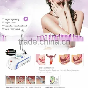 Co2 Fractional Laser Laser Type Cosmetic Surgery thumbnail-3