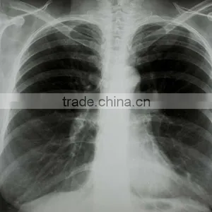 China CXR Film KND-A/F CE thumbnail-1