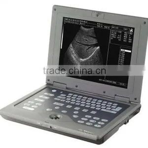 Ultrasound Scanner thumbnail-1
