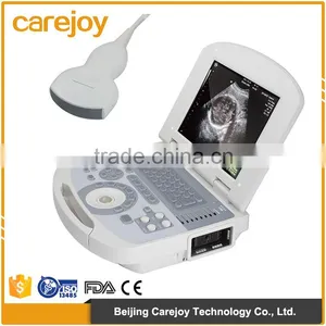 China Medical Human Use Ultrasound Scanner Portable Laptop thumbnail-1