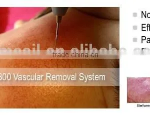 Painless Spider Veins Vascular Removal Machine thumbnail-6