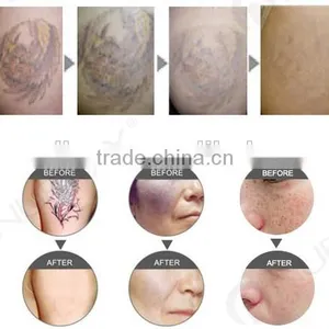 Big Pomotion !Professional Multifunctional Permanent Hair Removal Professional Laser Hair Removal Machine thumbnail-5