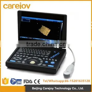 2016 New 3D Laptop Ultrasound Machine Low Price thumbnail-1