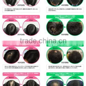 Best-selling and Healthy Wigs for Bald Women With Flavorful Made in Japan thumbnail-4