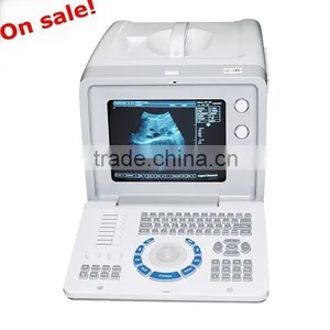 On Sale B Scan Image Portable Ultrasound Scanner Machine Ultrasonic Diagnostic System RUS-6000D With 3.5MHz Convex Probe thumbnail-1