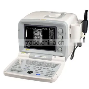 Hot Sale Cheap And Best Seller Portable Ultrasound Machine 2000G thumbnail-2