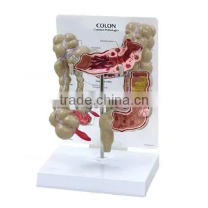 Pathology Colon Model Organs Human Body Anatomy thumbnail-3