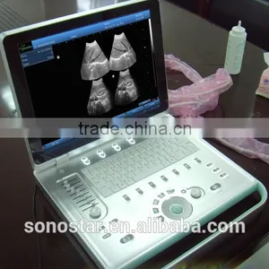 SS-9 PC Based Laptop Ultrasound B Scanner thumbnail-4