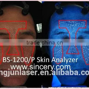 Body Slimming Equipment Tracking Treatment Machine 3D Skin Analyzer thumbnail-3