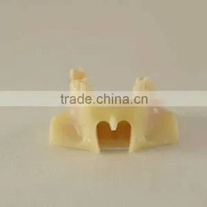 Dental Teaching Model,Human Dental Teaching Models,Dental Implant Model thumbnail-2