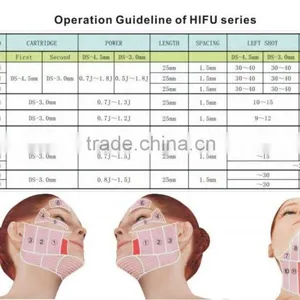 New Type HIFU-2S Face Lifting Machine/Wrinkle Remover Machine/Fat Loss Machine thumbnail-5