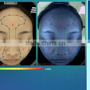 Computer Software Skin Analysis System Acne Wrinkle Spot Pore Analyzer Device thumbnail-4