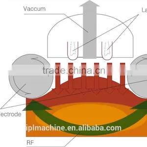 Roller Vacuum Cavitation Massage Machine thumbnail-4