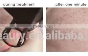 0.1-2.6mm Hottest Selling Laser Co2 Acne Scar Removal 10600nm /medical Fractional Co2 Laser Machine Birth Mark Removal thumbnail-6