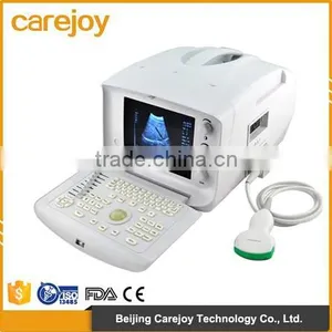 CE Approved Full Digital Portable Ultrasound Machine With 3.5Mhz Convex Probe thumbnail-1