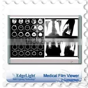 EdgeLight Slim Medical Film Viewer thumbnail-1