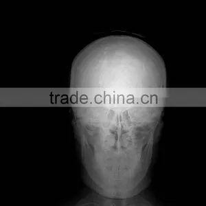 Ccd Flat Panel X-ray Detector 14x17 thumbnail-6