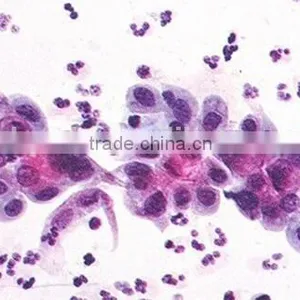 Lactobacillus SmearLactobacillus Smear Individual Microscope Prepared Slide thumbnail-1