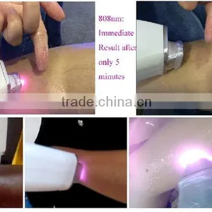 2015 Sell Hot Laser Diodo 808nm Machine for Painless Hair Removal thumbnail-6