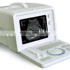 Full Digital Laptop Ultrasound Machine Price Portable Ultrasound Machine 2018CI thumbnail-2