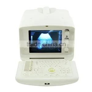 2016 Hot Sale Best Quality CE Approved Digital Portable Style Ultrasound Machine/Scanner For Sale With Cheap Price-Shelly thumbnail-4