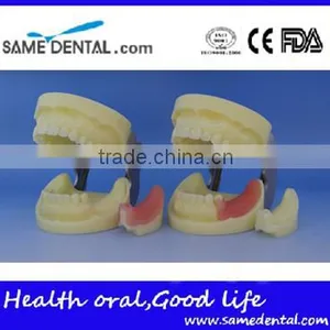 Dental Implant Practice Model DEA-31 Teeth Implant Models thumbnail-4