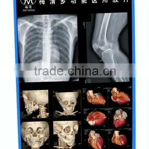 Meiqing cr Radiology thumbnail-1