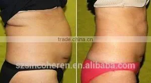 Sincoheren Coolplas Kryolipoplyse Body Massage Equipment and Cooling Machine thumbnail-6