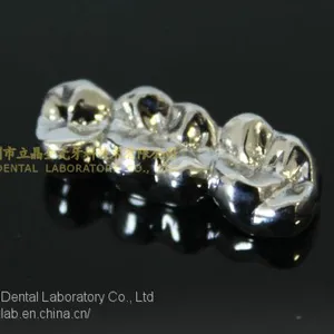 Full Metal Crown, FMC, FGC, Full Metal Post Core, Dental Crown, Cast Metal Crown, Dental Prosthesis, Laboratorio Dental, Dental Laboratory, Dentallabor, LJ Dental Lab China thumbnail-1