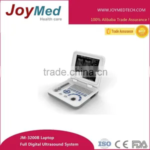 Popular White B Ultrasound Scanner Laptop Ultrasound Scan thumbnail-1