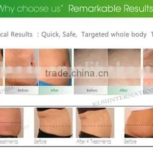 NIR Laser Vacuum RF Electrodes Skin Smoothing Tightening thumbnail-4