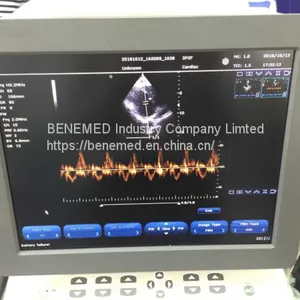 Echo Color Doppler Ultrasound Scanner Bene-5 thumbnail-4