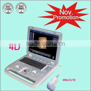(MSLCU18)Latest Handheld Laptop Color Doppler Medical Ultrasound Scan Machine 3D 4D thumbnail-1