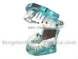 Human Dental Teaching Models,Dental Implant Model AC-P6 thumbnail-1