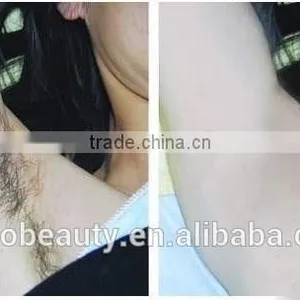 Technical E-light Ipl Shr Hair Removal Laser Machine/super Hair Removal 3 in 1 IPL Machine for Spa and Clinic thumbnail-6