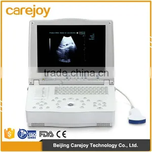 CE&ISO13485&FDA Approved Digital Portable Type 15-inch Laptop Ultrasound Scanner thumbnail-1