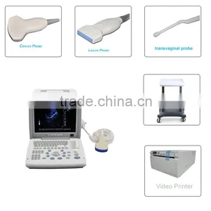 CE Approved Portable B-Mode Ultrasound Scanner With 3.5Mhz Multi-frequency Convex Probe RUS-9000B thumbnail-1