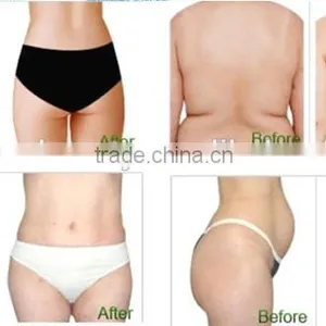 CE Fat Freezing Cryo Lipolysis Machine With 3 Different Size Handles thumbnail-5
