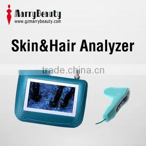 Specialized Beauty Equipment Hair Analysis and Skin Magnifier Analyzer thumbnail-1
