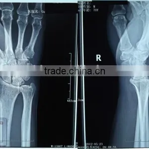 Fuji Medical X-ray Film, X-ray Blue Film From Zhejiang Hangzhou thumbnail-1