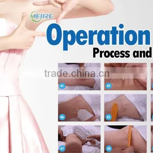 New Design Ipl Shr Opt Laser Permanent Ipl Equipment thumbnail-2