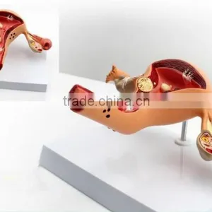 Human Uterus and Ovary Vaginal Pathological Changes Model of Reproductive Department of Gynecology Medical Demonstration Model thumbnail-6