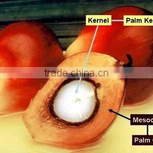 Palm Kernel Expeller Oil Press Machine thumbnail-2