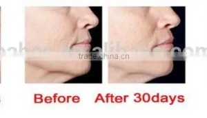 Red Light Anti Ageing Heat Skin Rejuvenation Beauty Device thumbnail-4