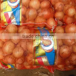 2015 Chinese Fresh Yellow Onion thumbnail-1