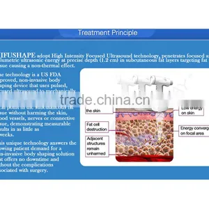 CE Approved Body Slimming Non-surgical Hifu Slimming Machine for Weight Loss thumbnail-5