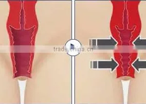 0.1-2J Portable Safety Color Touch Screen Vaginal Rejuvenation HIFU / HIFU Machine High Intensity Focused Ultrasound thumbnail-6